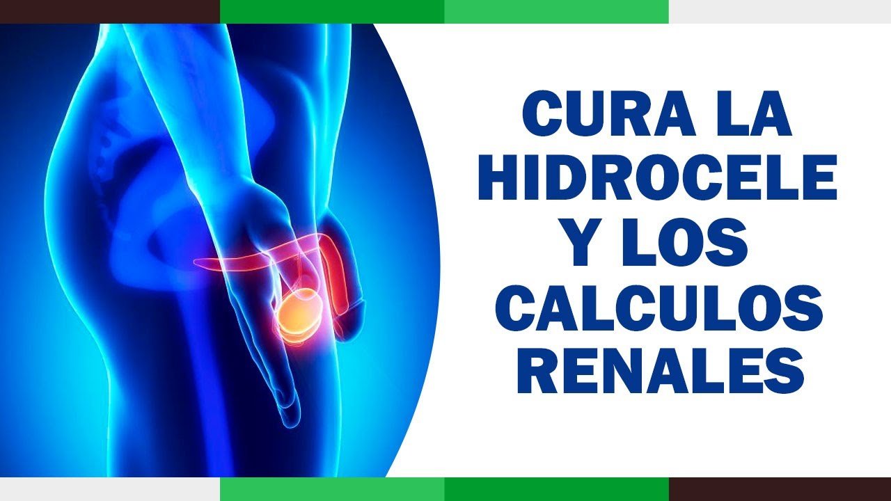 tratamiento de hidrocele