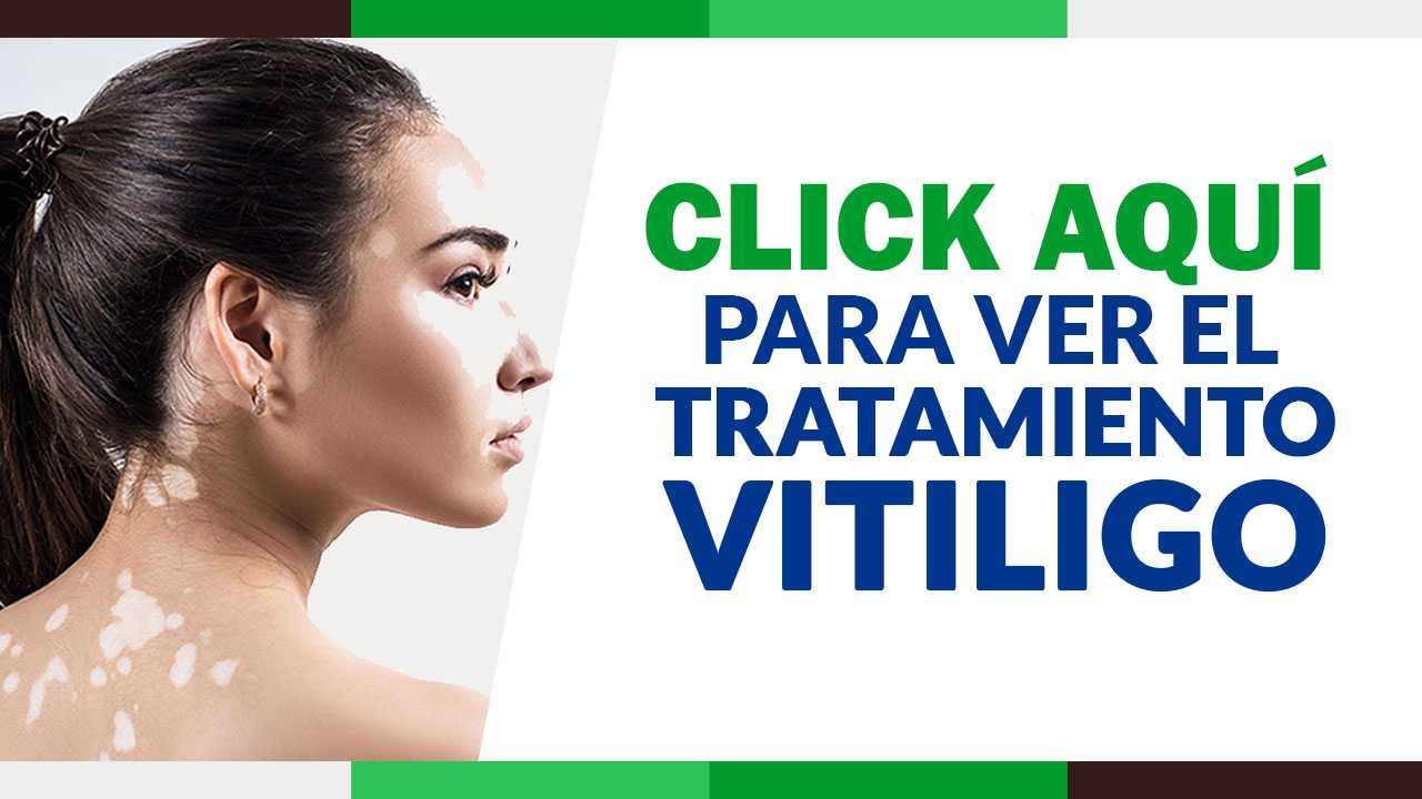 vitiligo tiene cura Gold Green Tratamientos